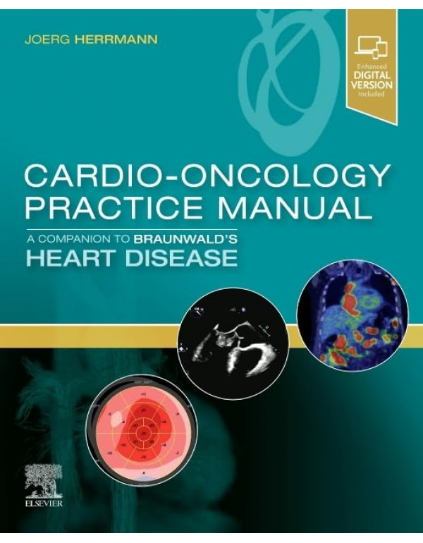 Cardio-Oncology Practice Manual: A Companion to Br...
