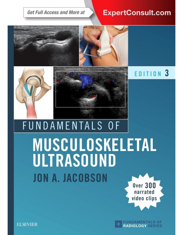 Fundamentals of Musculoskeletal Ultrasound (Fundam...