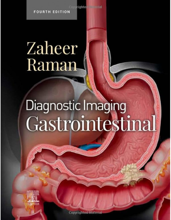 Diagnostic Imaging: Gastrointestinal 4th Ed. by At...
