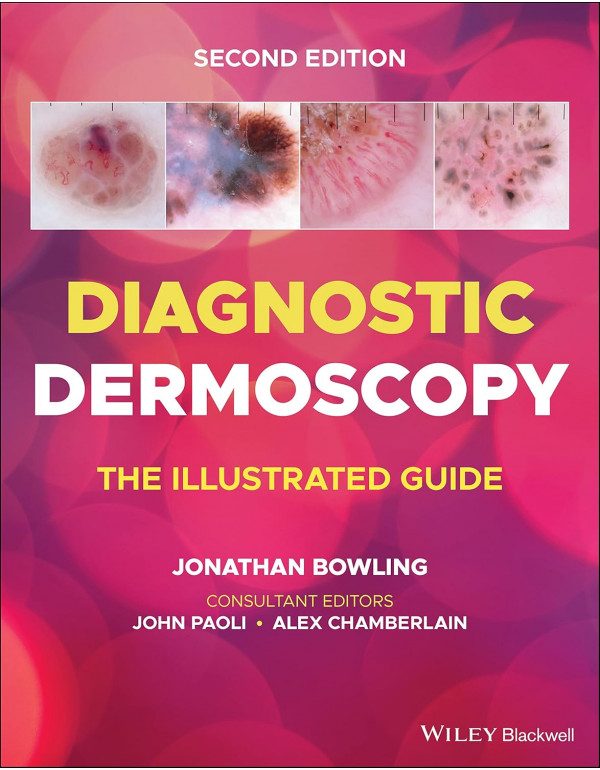 Diagnostic Dermoscopy: The Illustrated Guide (2nd ...
