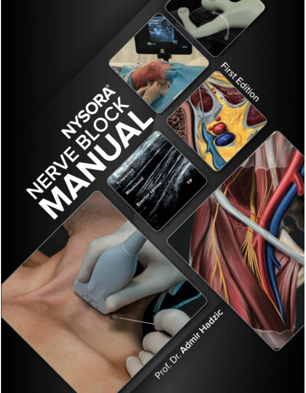 NYSORA Nerve Block Manual, First Edition by Admir ...
