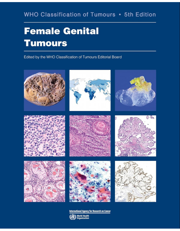 Female Genital Tumours: WHO Classification of Tumo...