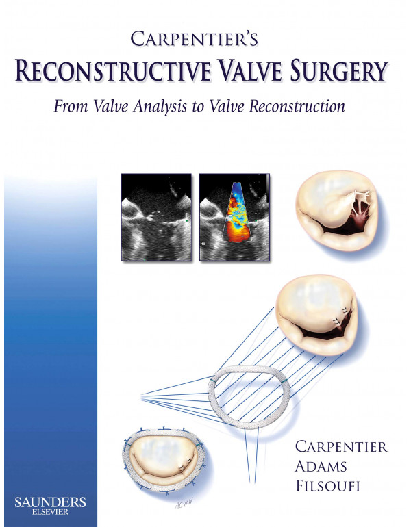 Carpentier's Reconstructive Valve Surgery (ISBN 97...