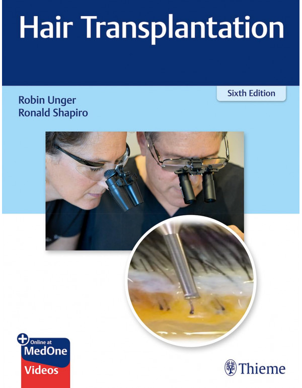 Hair Transplantation, 6th edition by Robin Unger, ...