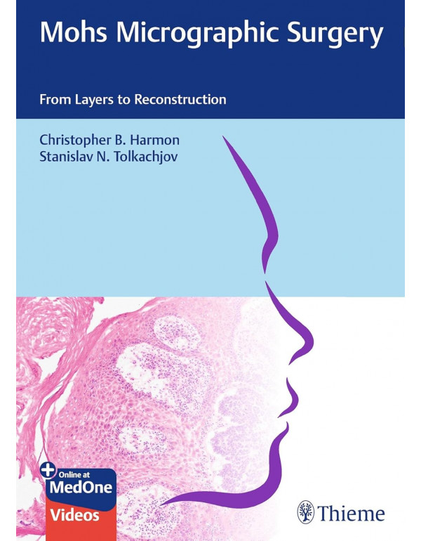 Mohs Micrographic Surgery: From Layers to Reconstr...